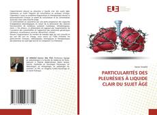 Copertina di PARTICULARITÉS DES PLEURÉSIES À LIQUIDE CLAIR DU SUJET ÂGÉ