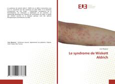 Le syndrome de Wiskott Aldrich kitap kapağı