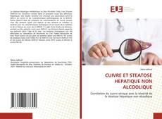 Copertina di CUIVRE ET STEATOSE HEPATIQUE NON ALCOOLIQUE