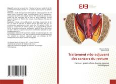 Buchcover von Traitement néo-adjuvant des cancers du rectum