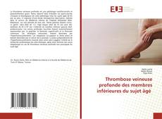 Thrombose veineuse profonde des membres inférieures du sujet âgé kitap kapağı