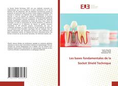 Les bases fondamentales de la Socket Shield Technique kitap kapağı