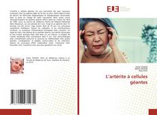 L’artérite à cellules géantes kitap kapağı