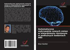 Buchcover von Automatyczne wykrywanie nowych zmian w stwardnieniu rozsianym w podłużnych badaniach MRI