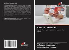 Portada del libro de Cancro cervicale