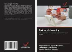 Обложка Rak szyjki macicy