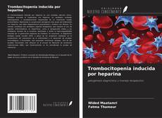 Buchcover von Trombocitopenia inducida por heparina