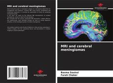 Couverture de MRI and cerebral meningiomas
