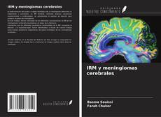Copertina di IRM y meningiomas cerebrales