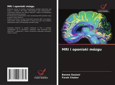 Bookcover of MRI i oponiaki mózgu