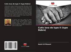 Copertina di Cutis laxa de type II (type Debre)