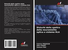 Capa do livro de Disturbi dello spettro della neuromielite optica e sistema HLA 