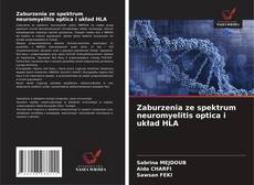 Обложка Zaburzenia ze spektrum neuromyelitis optica i układ HLA