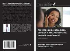 Capa do livro de ASPECTOS EPIDEMIOLÓGICOS, CLÍNICOS Y TERAPÉUTICOS DEL ERITEMA PIGMENTARIO 