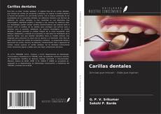 Capa do livro de Carillas dentales 