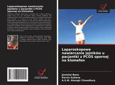 Buchcover von Laparoskopowe nawiercanie jajników u pacjentki z PCOS opornej na klomefen
