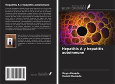 Buchcover von Hepatitis A y hepatitis autoinmune
