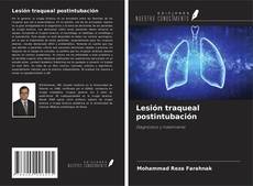 Copertina di Lesión traqueal postintubación