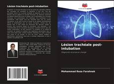 Buchcover von Lésion trachéale post-intubation