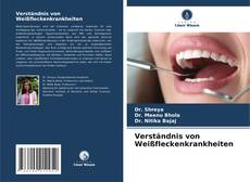 Bookcover of Verständnis von Weißfleckenkrankheiten