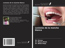 Capa do livro de Lesiones de la mancha blanca 