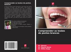 Bookcover of Compreender as lesões de pontos brancos