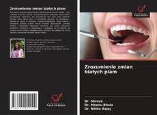 Обложка Zrozumienie zmian białych plam