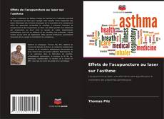 Couverture de Effets de l'acupuncture au laser sur l'asthme