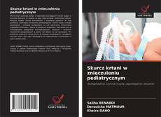 Bookcover of Skurcz krtani w znieczuleniu pediatrycznym