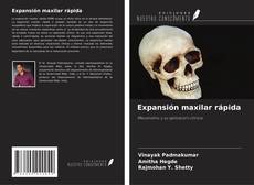 Buchcover von Expansión maxilar rápida