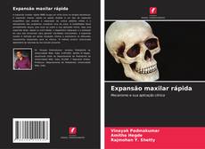 Buchcover von Expansão maxilar rápida