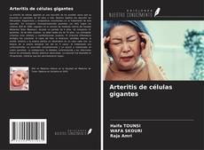 Borítókép a  Arteritis de células gigantes - hoz