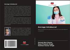 Couverture de Ancrage intrabuccal