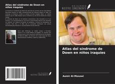 Borítókép a  Atlas del síndrome de Down en niños iraquíes - hoz