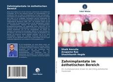 Zahnimplantate im ästhetischen Bereich kitap kapağı