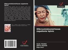 Olbrzymiokomórkowe zapalenie tętnic kitap kapağı