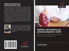 Buchcover von Opieka zdrowotna po przeszczepieniu nerki