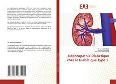 Copertina di Néphropathie Diabétique chez le Diabétique Type 1