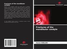 Обложка Fractures of the mandibular condyle