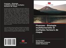 Copertina di Fluorose - Étiologie multifactorielle et multiples facteurs de risque