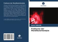 Bookcover of Frakturen der Mandibularkondyle