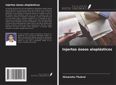 Portada del libro de Injertos óseos aloplásticos