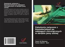 Capa do livro de Zakażenia związane z biomateriałami po zabiegach chirurgicznych w obrębie jamy ustnej 