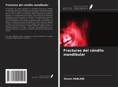 Capa do livro de Fracturas del cóndilo mandibular 