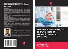 REDEFINIR SORRISOS: OPÇÕES DE TRATAMENTO DA EXPOSIÇÃO GENGIVAL EXCESSIVA的封面