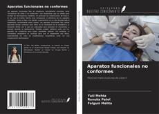 Bookcover of Aparatos funcionales no conformes