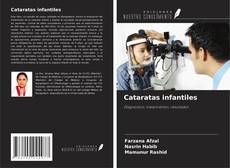 Couverture de Cataratas infantiles