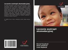 Couverture de Leczenie esotropii akomodacyjnej