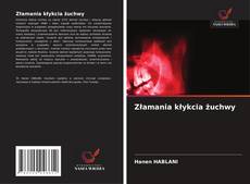 Capa do livro de Złamania kłykcia żuchwy 