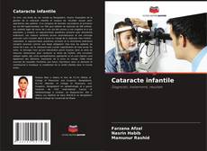 Bookcover of Cataracte infantile